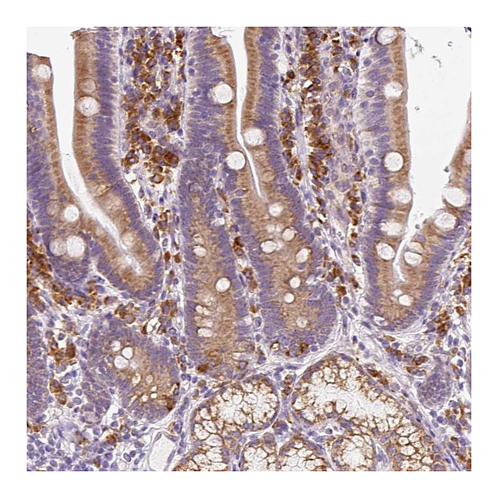 Atlas Antibodies Anti-DDOST Antibody