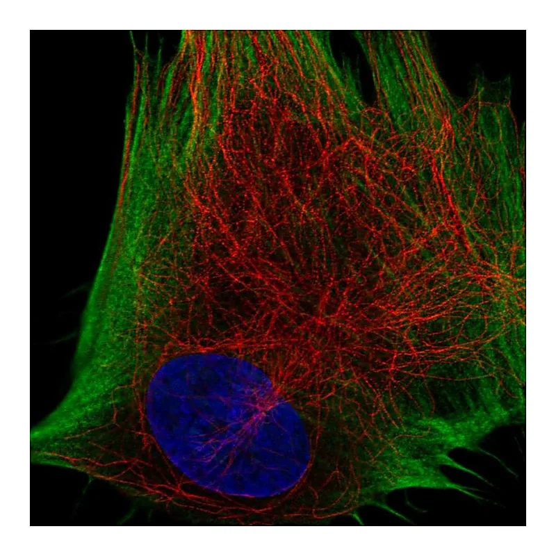 Atlas Antibodies Anti-DDR2 Antibody