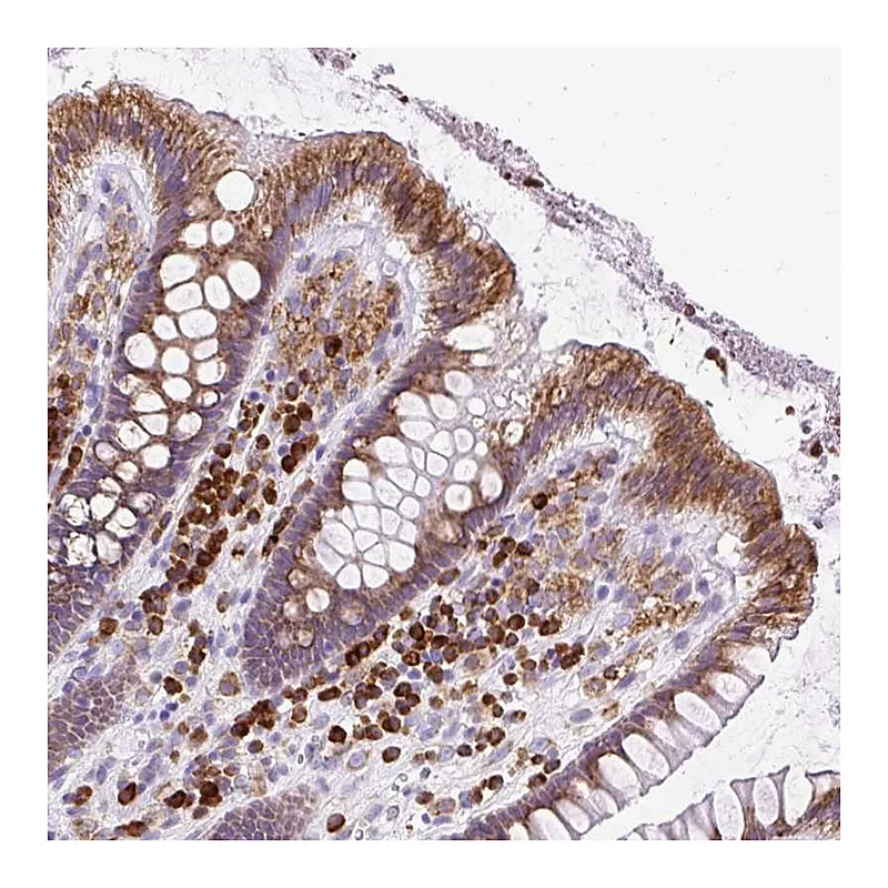 Atlas Antibodies Anti-DDOST Antibody