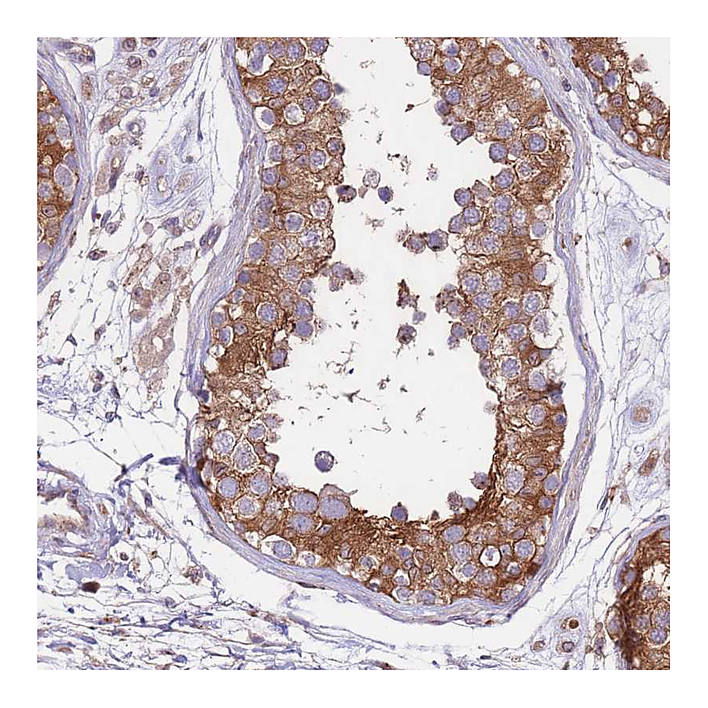 Atlas Antibodies Anti-DDX19B Antibody