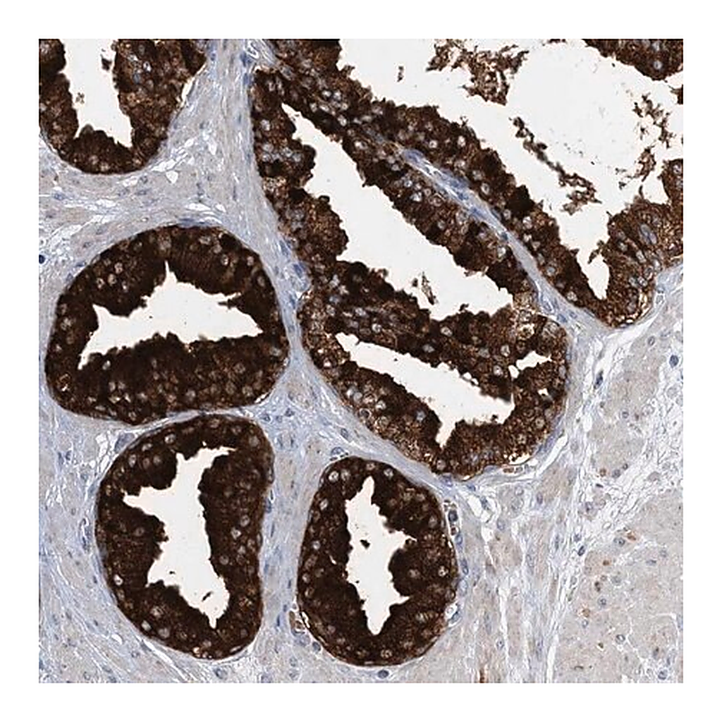 Merck Anti-TRAPPC13 antibody produced in rabbit