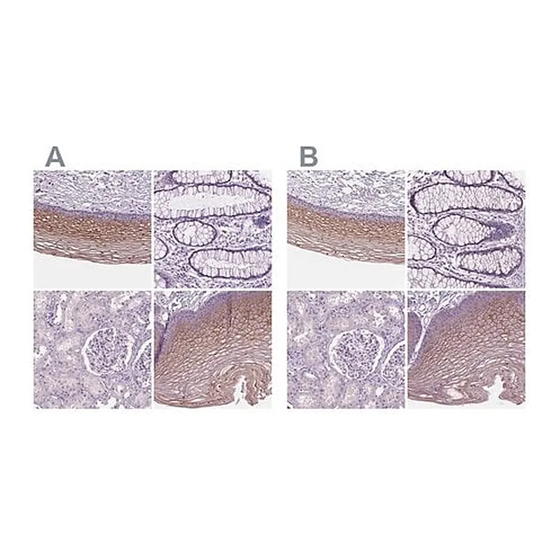 Merck Anti-SBSN antibody produced in rabbit