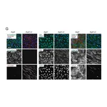 Merck Monoclonal Anti-Vimentin antibody produced in mouse