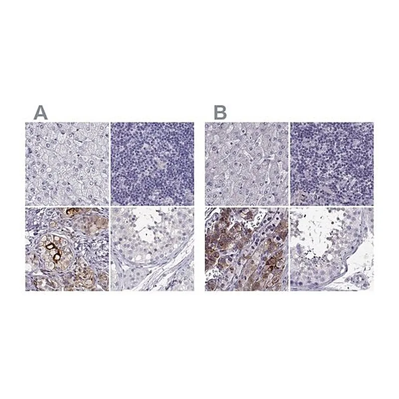 Merck Anti-IGSF1 antibody produced in rabbit