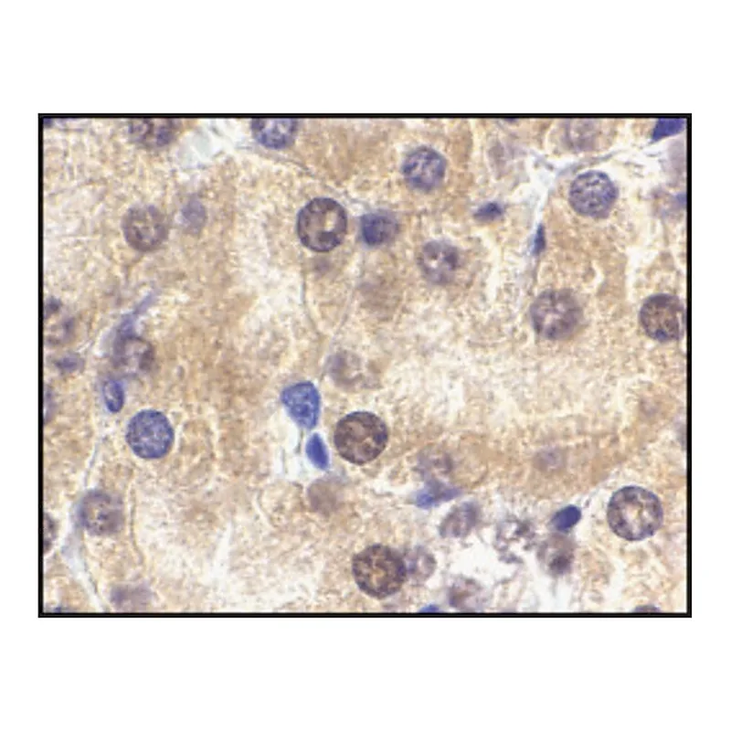 Merck Anti-ST2 antibody produced in rabbit