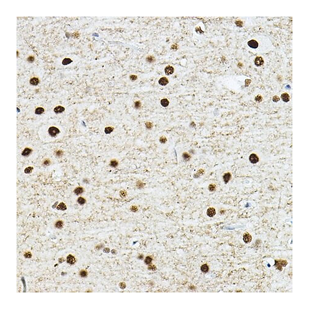 Merck Anti-TEAD1 antibody produced in rabbit