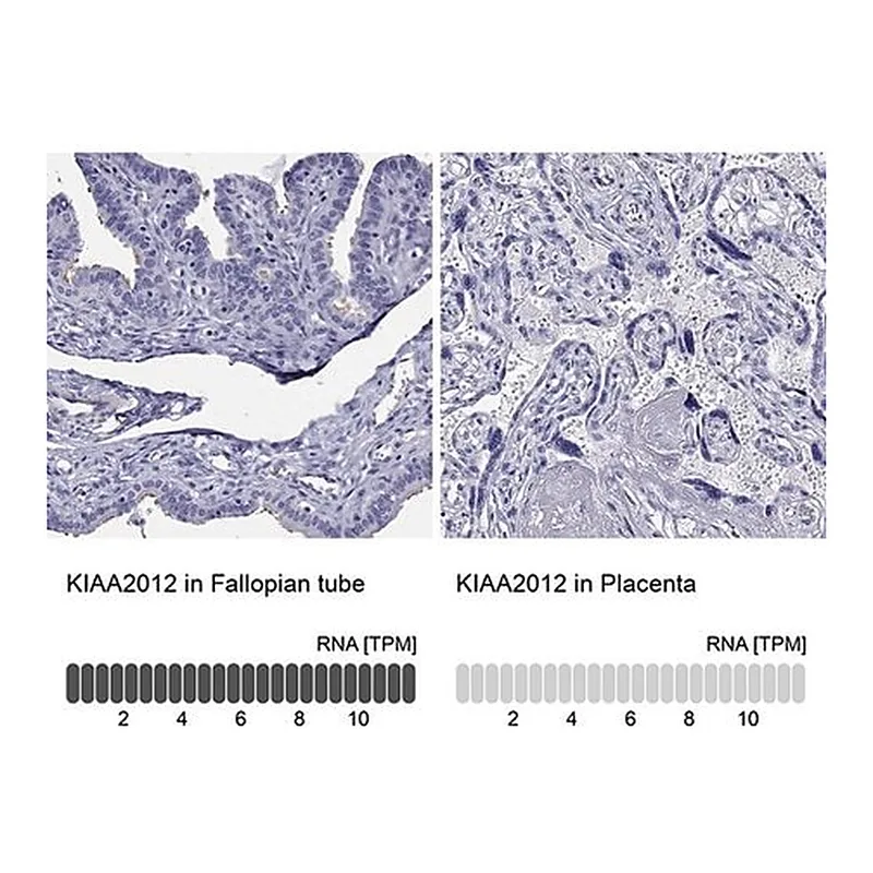 Merck Anti-KIAA2012 antibody produced in rabbit