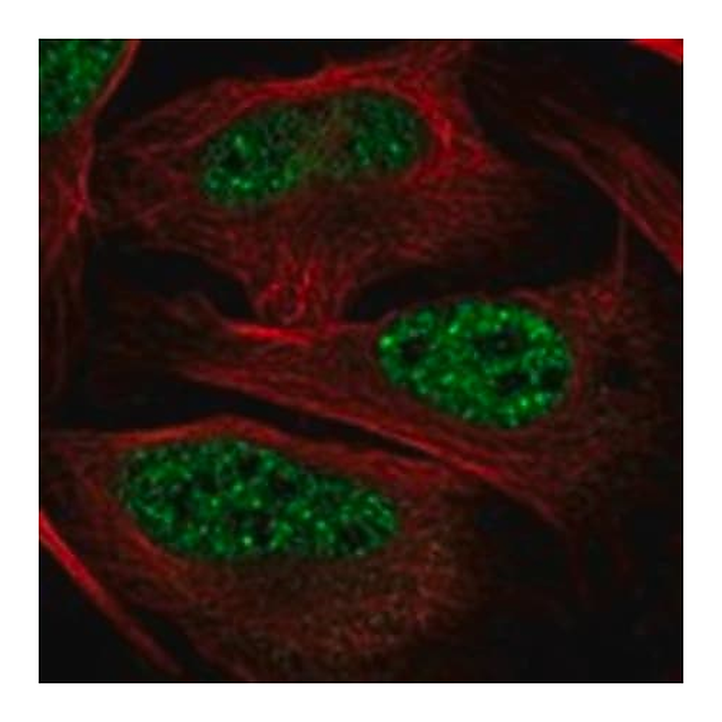 Merck Anti-ZFAND6 antibody produced in rabbit