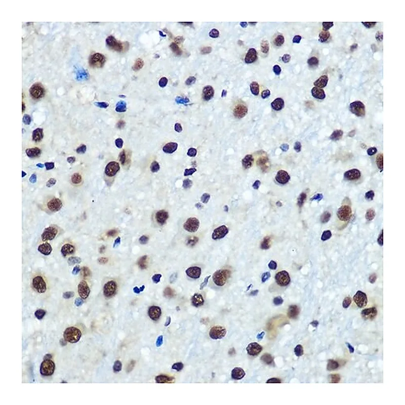 Merck Anti-hnRNP K antibody produced in rabbit
