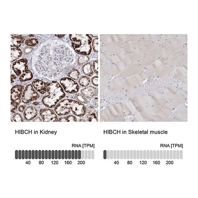 Merck Anti-HIBCH antibody produced in rabbit