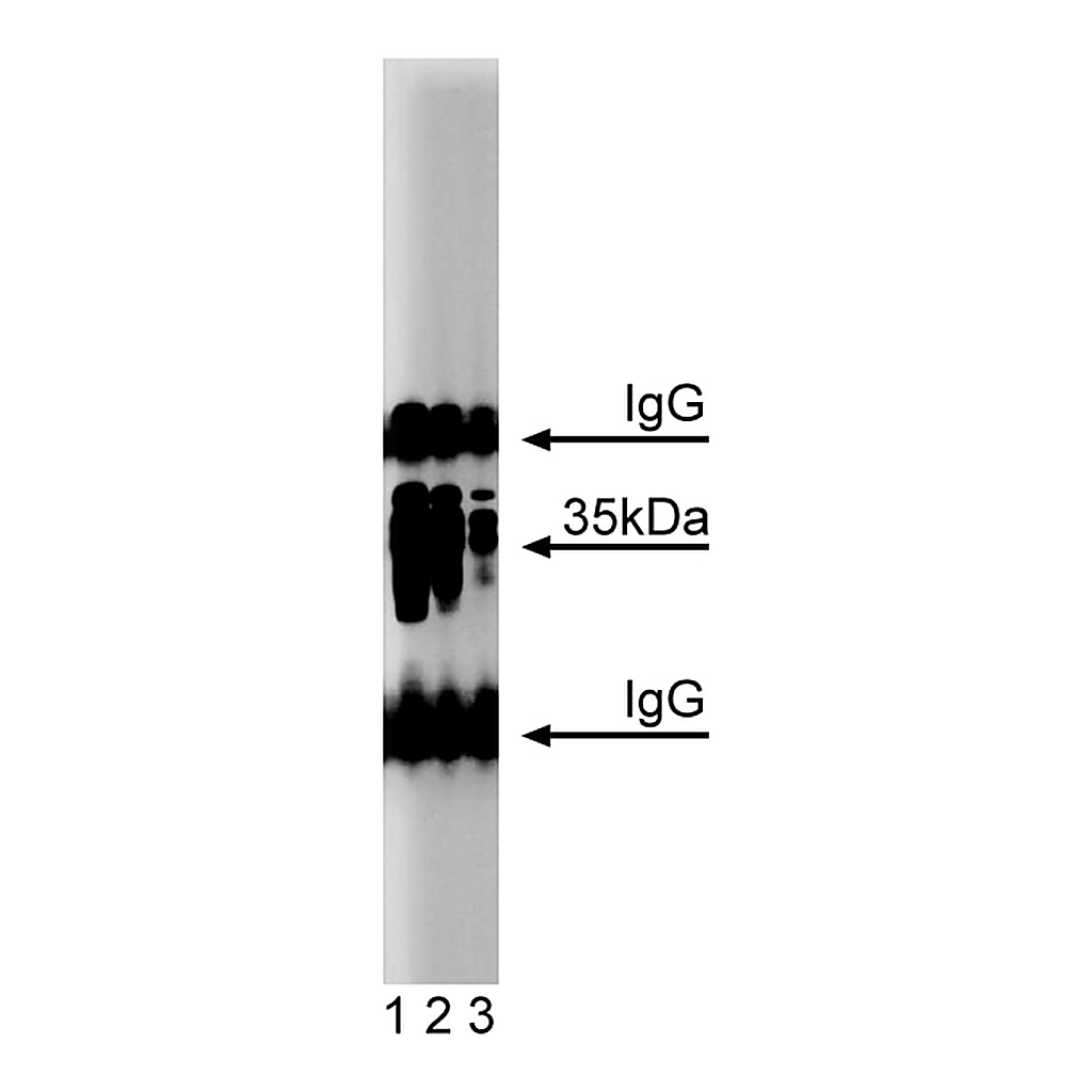 BD Purified Mouse Anti-Arginase I