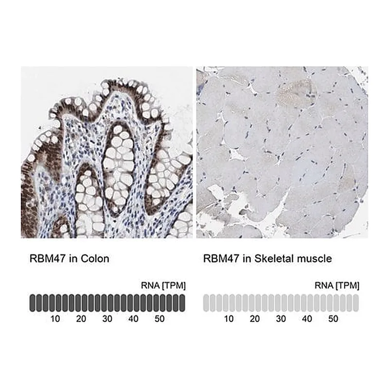 Merck Anti-RBM47 antibody produced in rabbit
