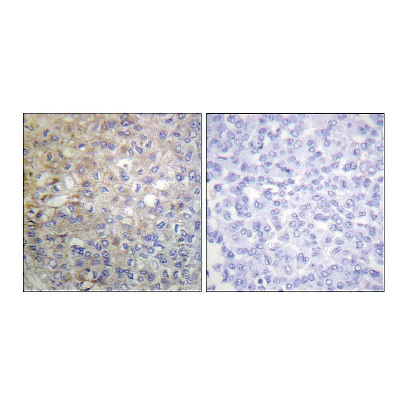 Merck Anti-FGFR1 antibody produced in rabbit