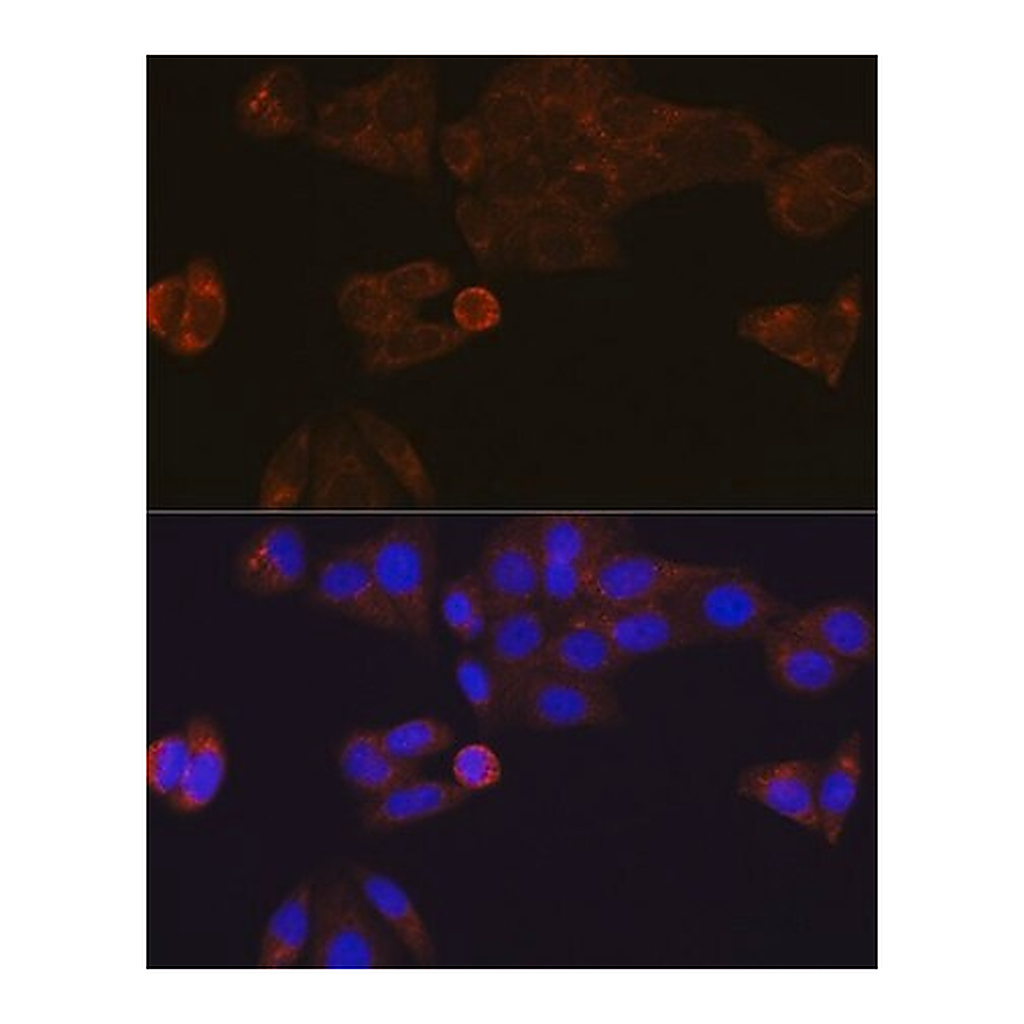 Merck Anti-CES1 antibody produced in rabbit