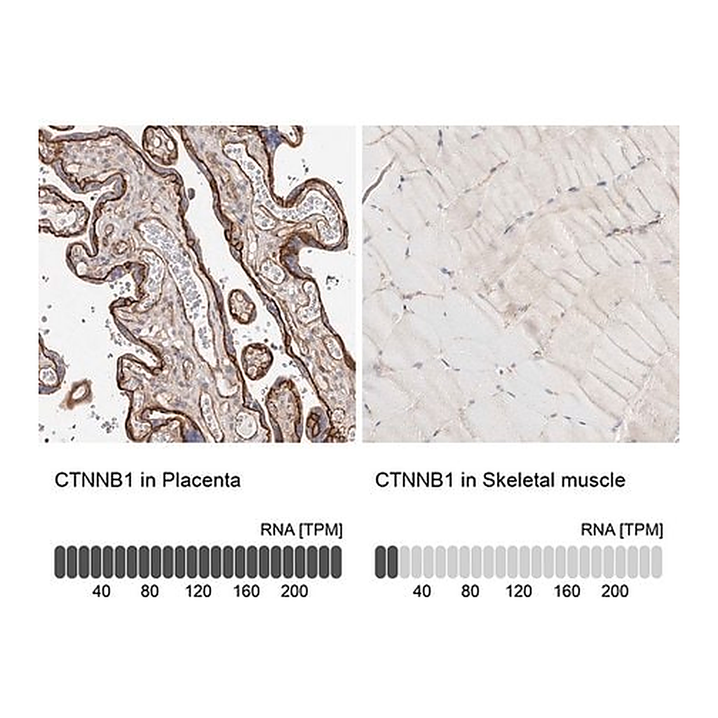 Merck Anti-CTNNB1 antibody produced in rabbit