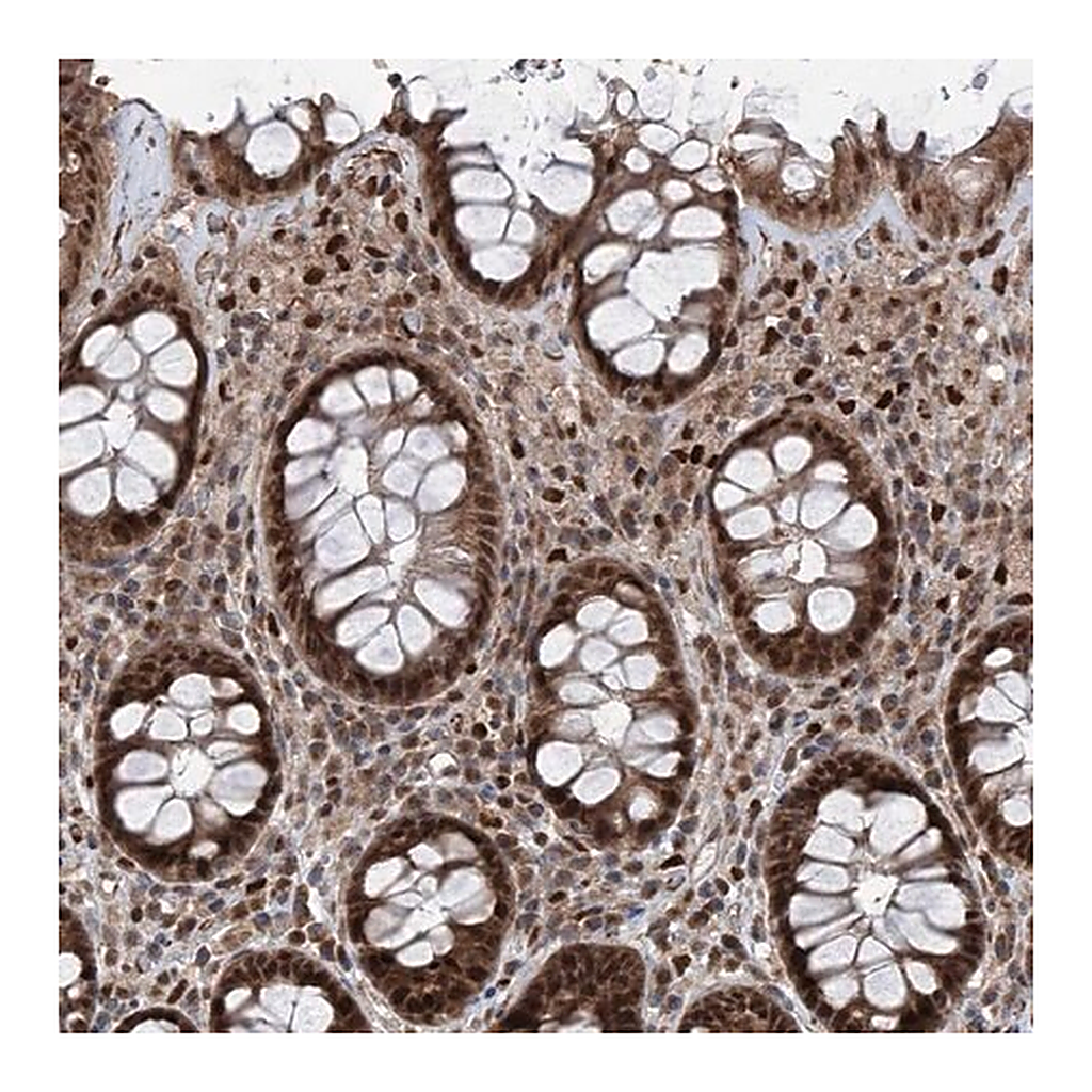 Merck Anti-FKBP5 antibody produced in rabbit