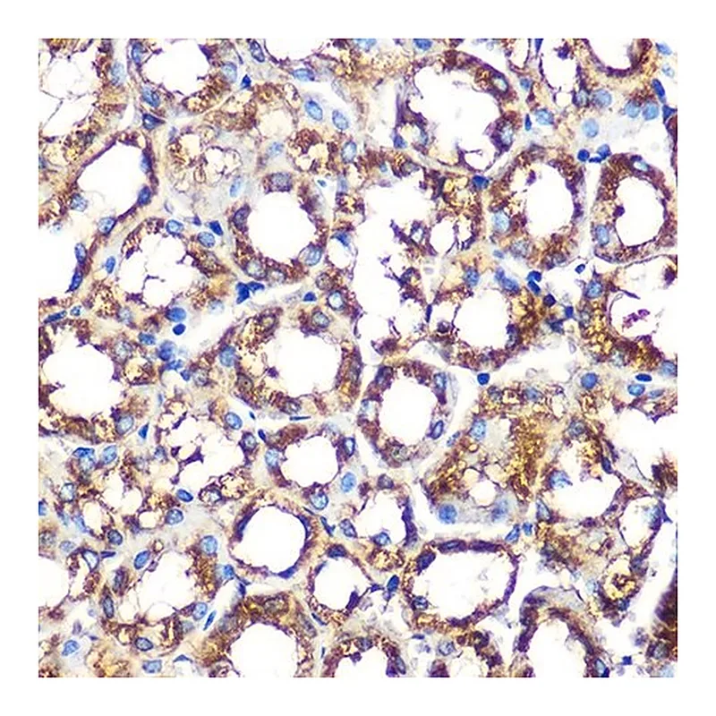 Merck Anti-NOXA2/p67phox antibody produced in rabbit