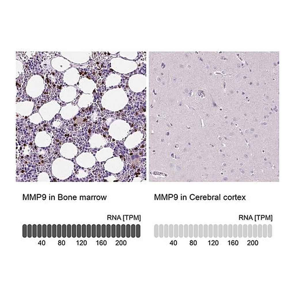 Merck Anti-MMP9 antibody produced in rabbit