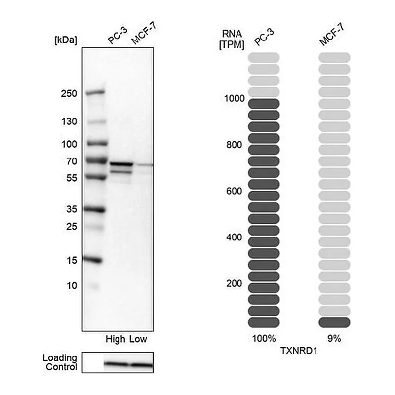 Merck Anti-TXNRD1 antibody produced in rabbit