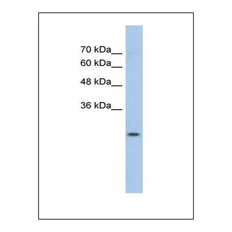 Merck Anti-GSTM1 antibody produced in rabbit