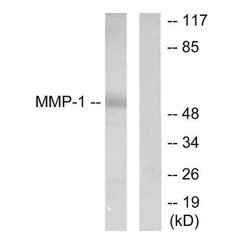 Merck Anti-MMP-1 antibody produced in rabbit