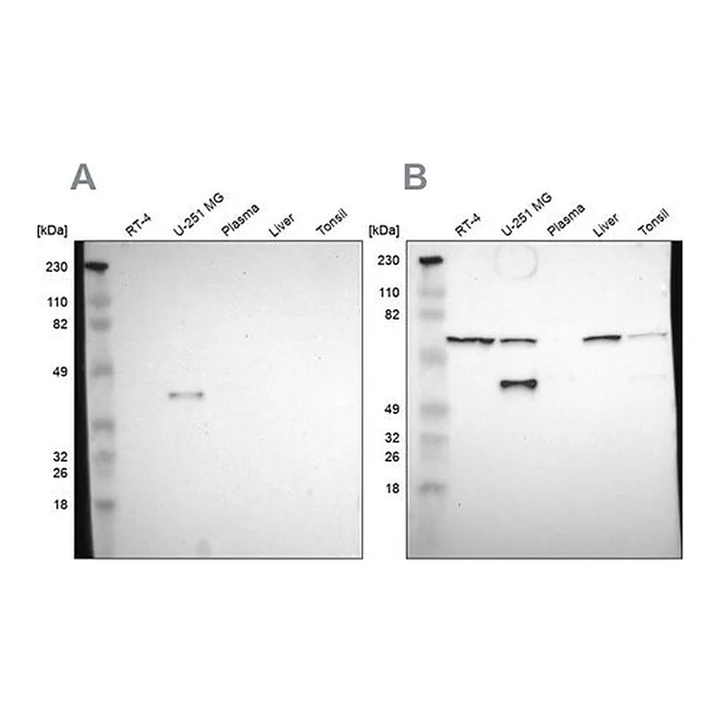 Merck Anti-SPARC antibody produced in rabbit