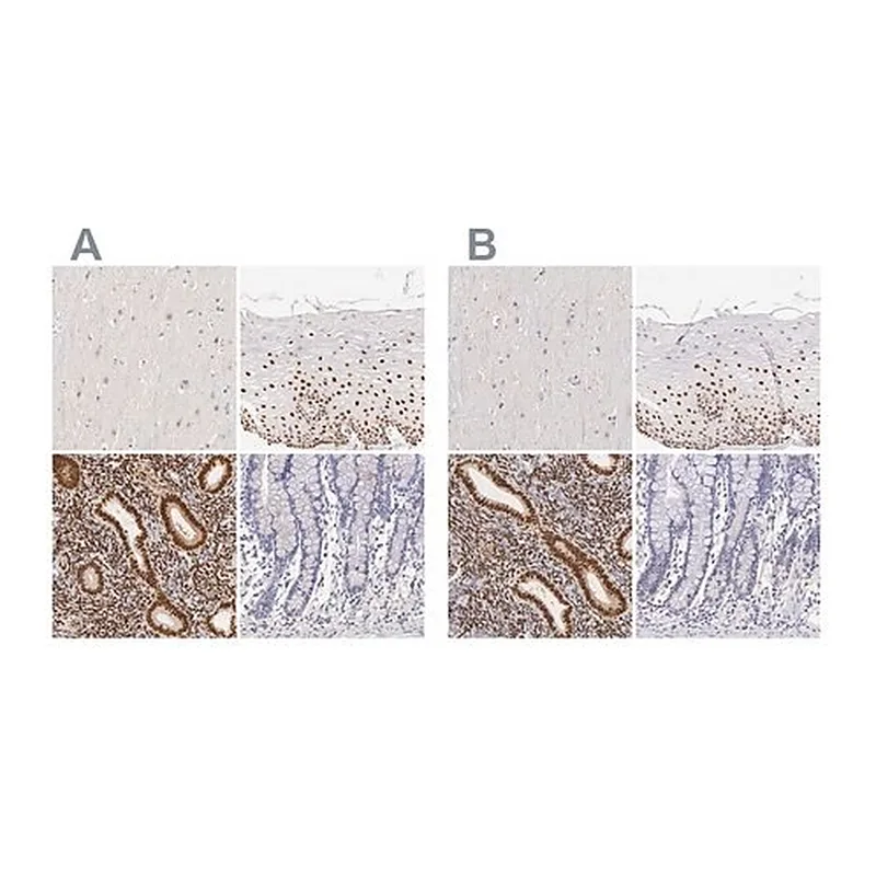 Merck Anti-ESR1 antibody produced in rabbit