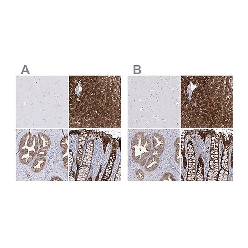 Merck Anti-UGDH antibody produced in rabbit