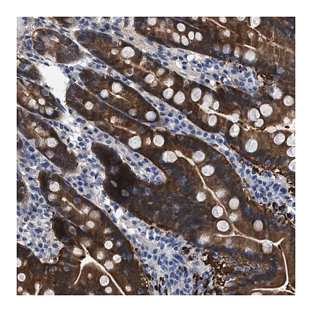 Merck Anti-CBR1 antibody produced in rabbit
