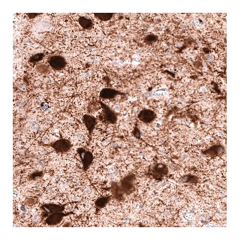 Merck Anti-SLC18A2 antibody produced in mouse