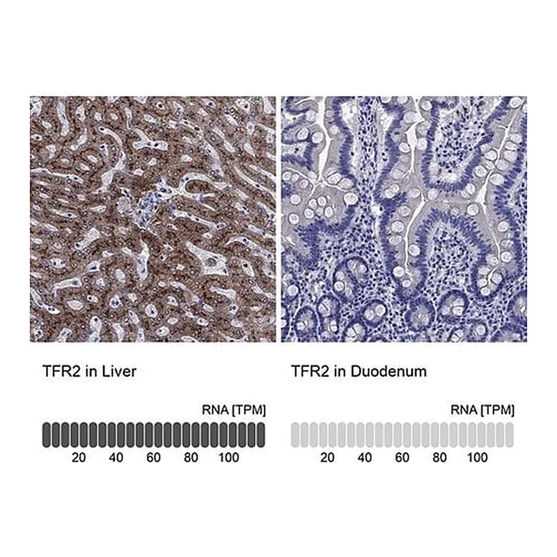 Merck Anti-TFR2 antibody produced in rabbit