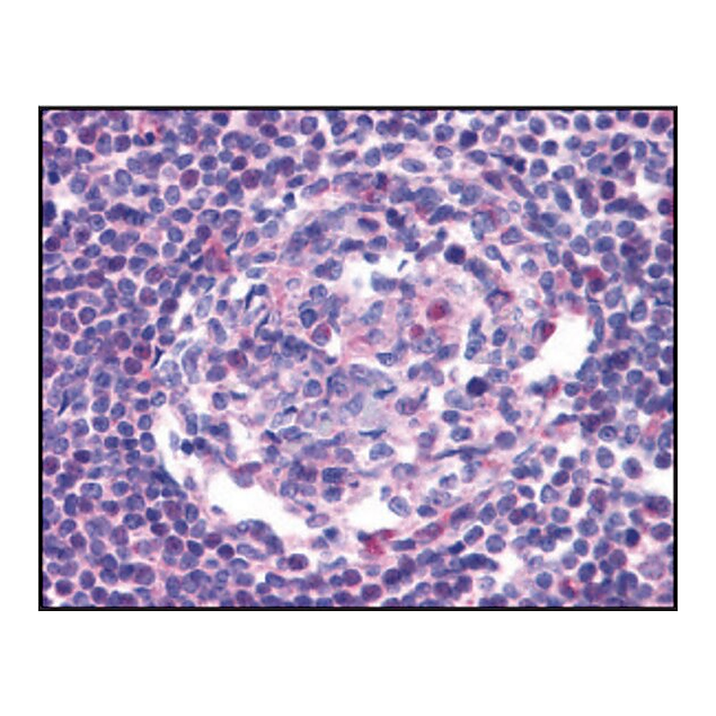 Merck Anti-CCR5 antibody produced in rabbit