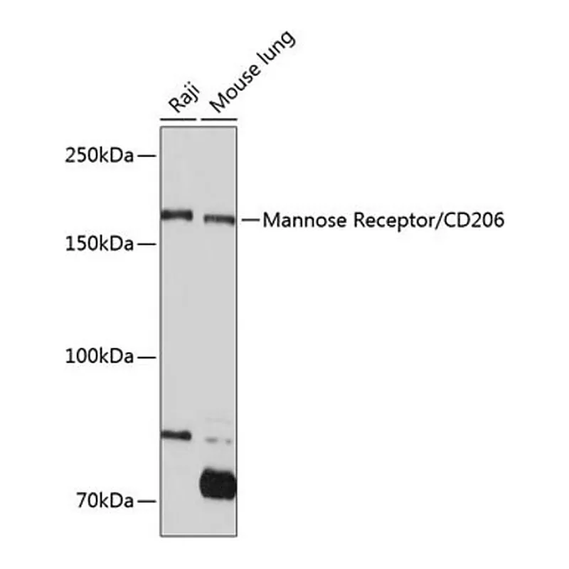 Merck Anti-Mannose Receptor/CD206 antibody produced in rabbit