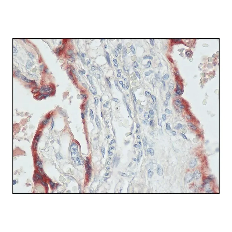 Merck Anti-Chorionic Gonadotropin (alpha+beta subunits) (HCG) antibody produced in rabbit