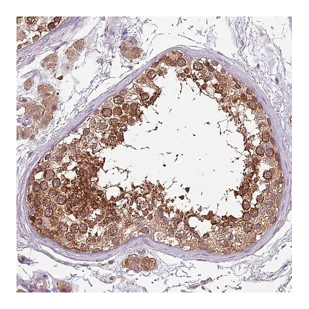 Merck Anti-USP32 antibody produced in rabbit