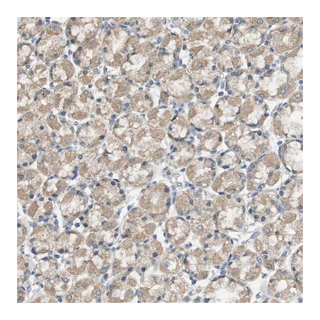 Merck Anti-ZDHHC20 antibody produced in rabbit