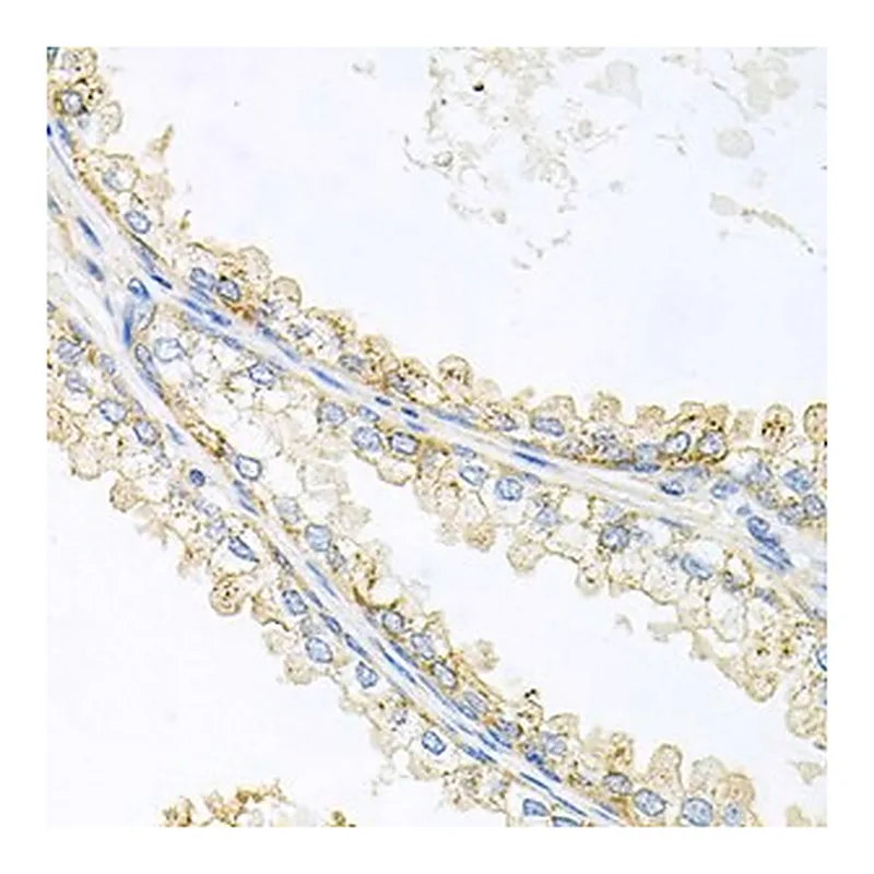 Merck ANTI-CD133 ANTIBODY PRODUCED IN RABBIT