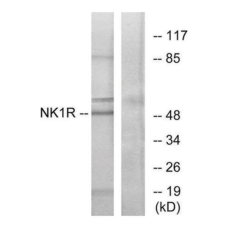 Merck Anti-NK1R antibody produced in rabbit