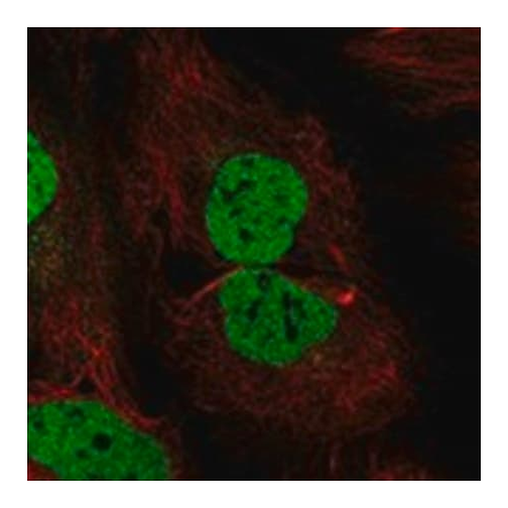 Merck Anti-WAPL antibody produced in rabbit