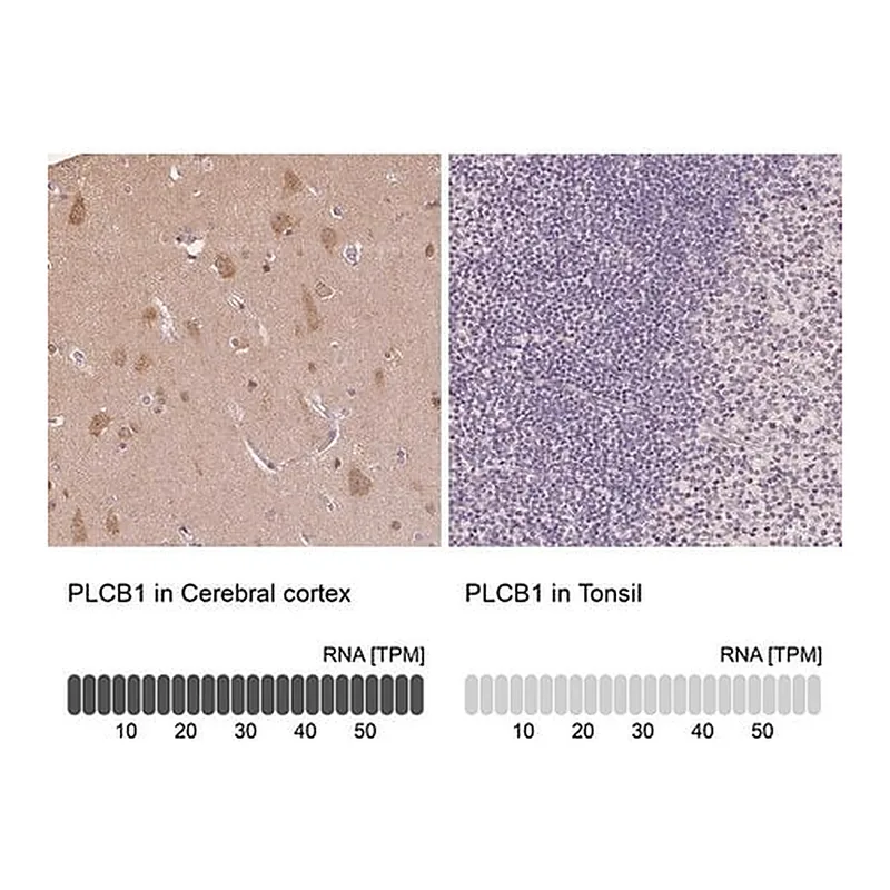 Merck Anti-PLCB1 antibody produced in rabbit