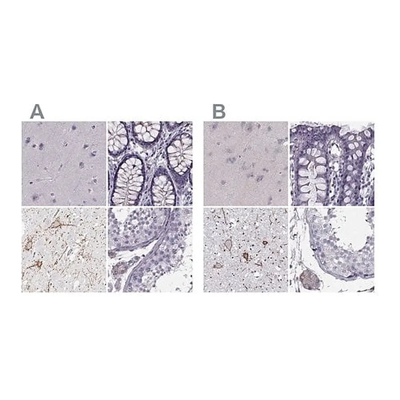 Merck Anti-CALCR antibody produced in rabbit