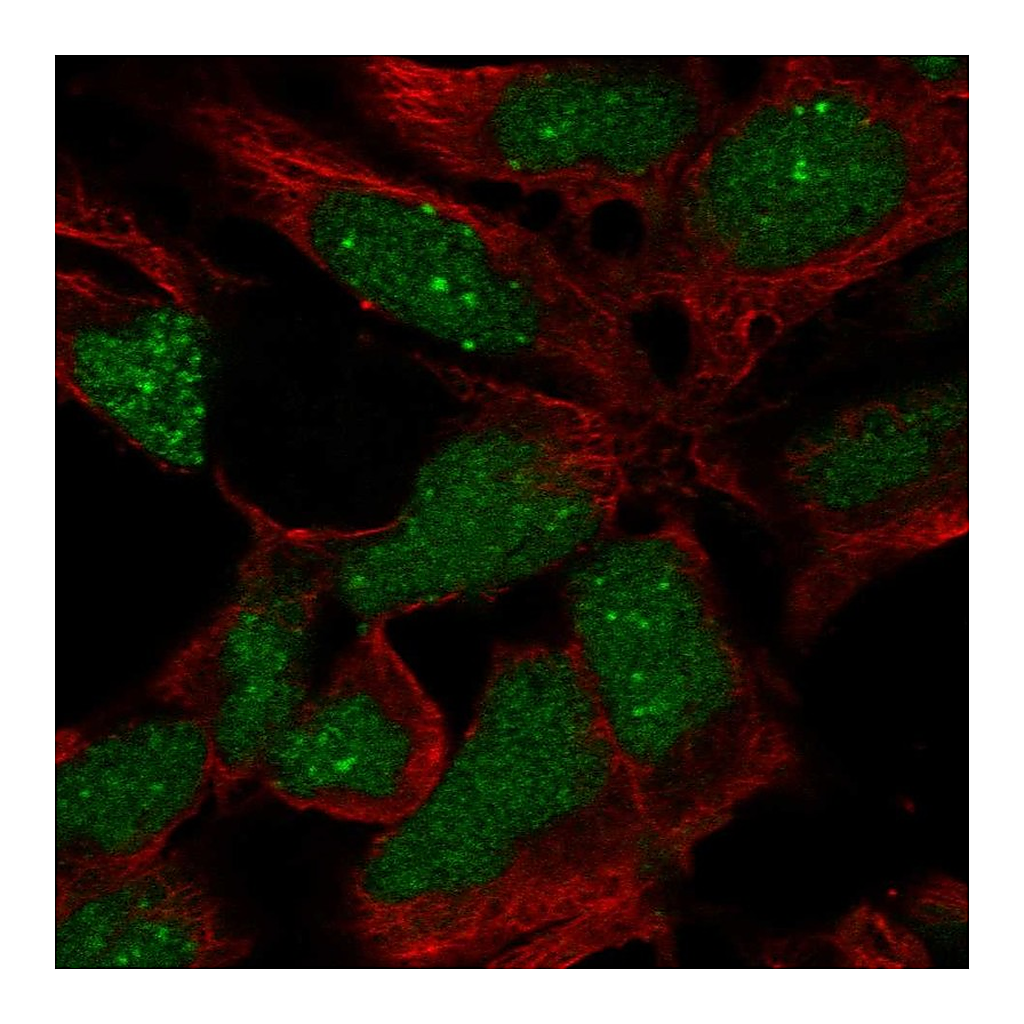 Atlas Antibodies Anti-RP11-302B13.5 Antibody