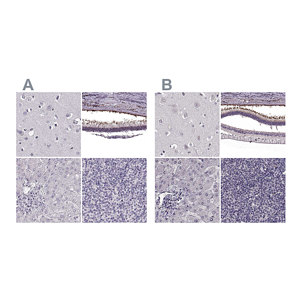 Atlas Antibodies Anti-RP1L1 Antibody