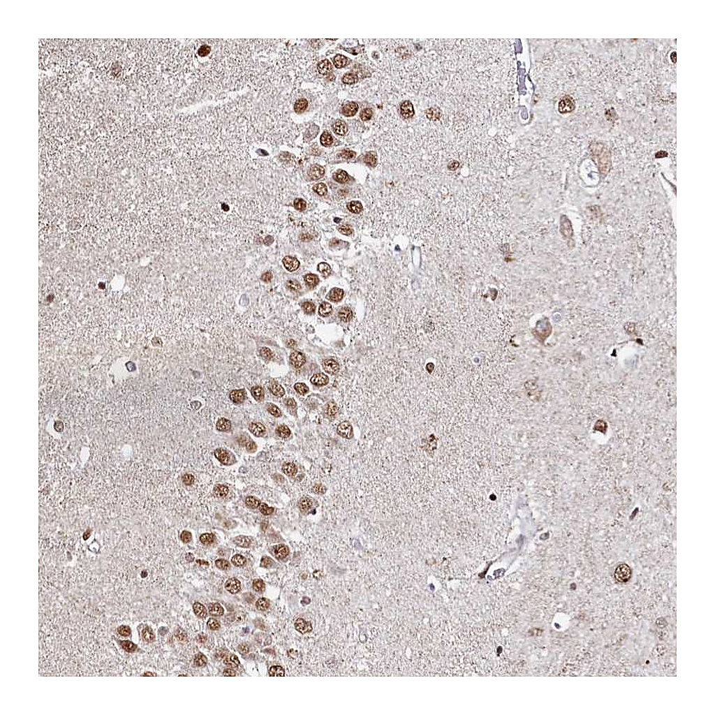 Atlas Antibodies Anti-RP11-382A20.3 Antibody