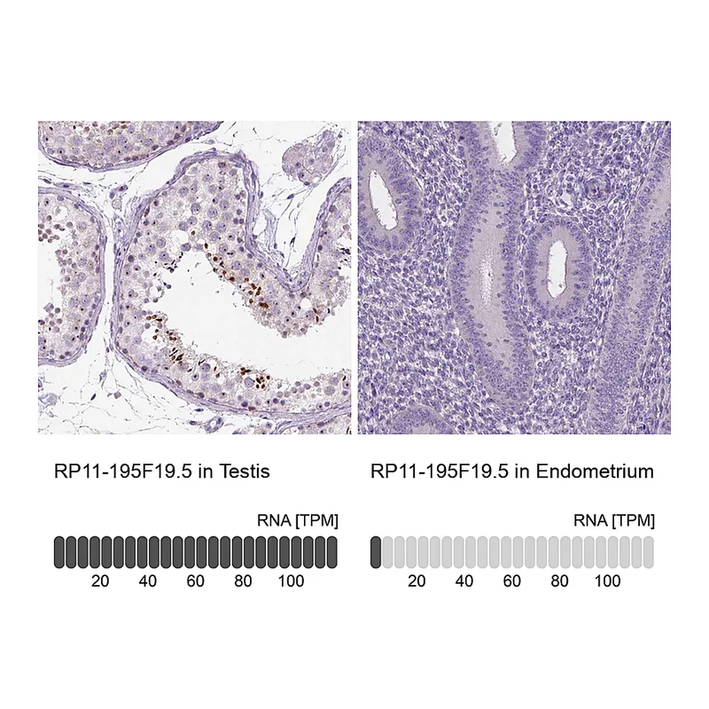 Atlas Antibodies Anti-RP11-195F19.5 Antibody