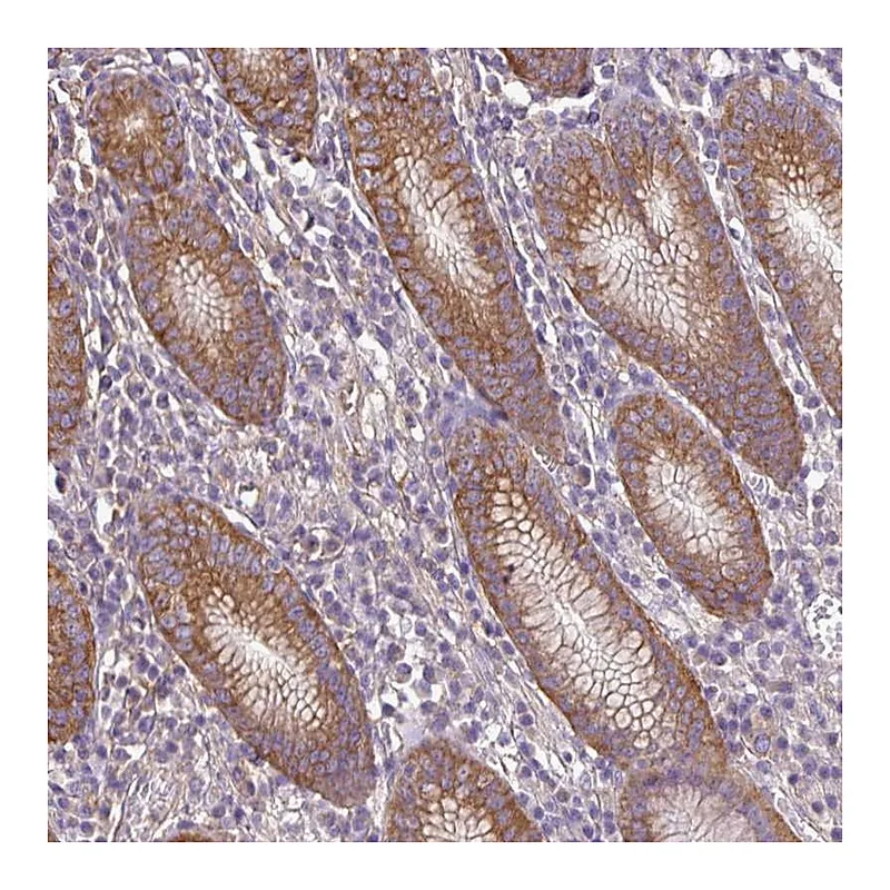 Atlas Antibodies Anti-RP11-849H4.2 Antibody