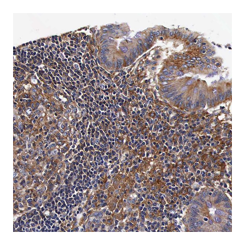 Atlas Antibodies Anti-RP2 Antibody