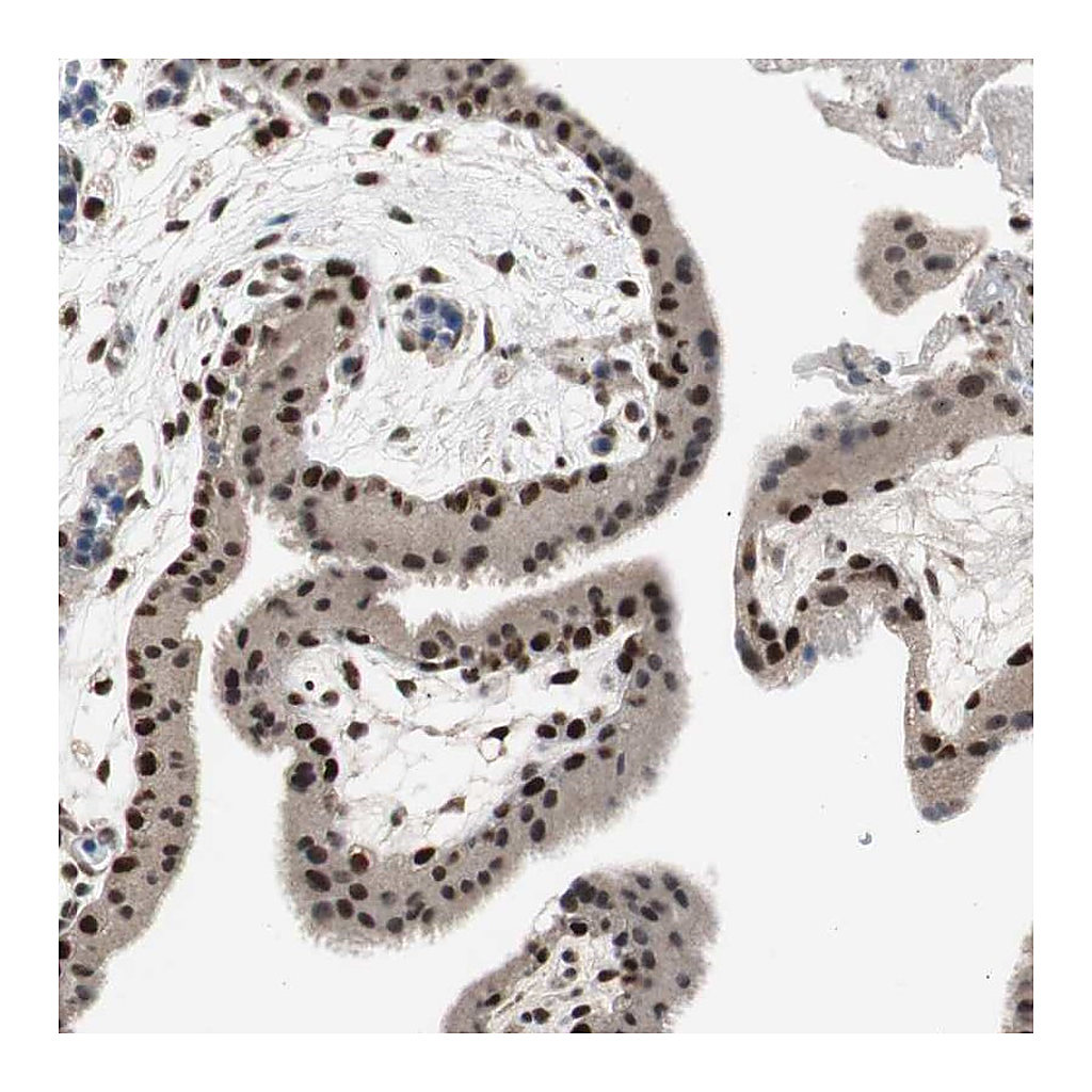 Atlas Antibodies Anti-RPA1 Antibody