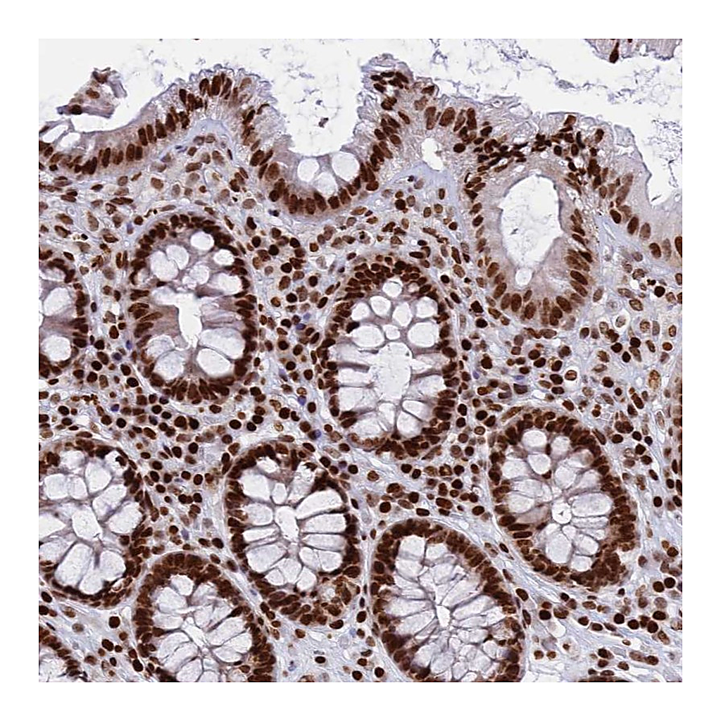 Atlas Antibodies Anti-RPAP1 Antibody