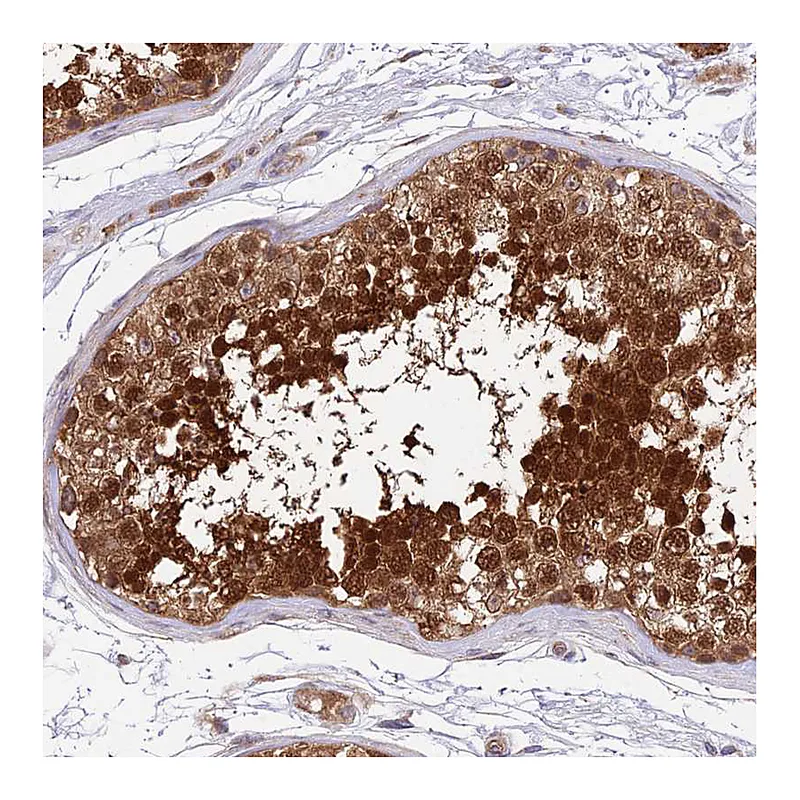 Atlas Antibodies Anti-RPAP2 Antibody